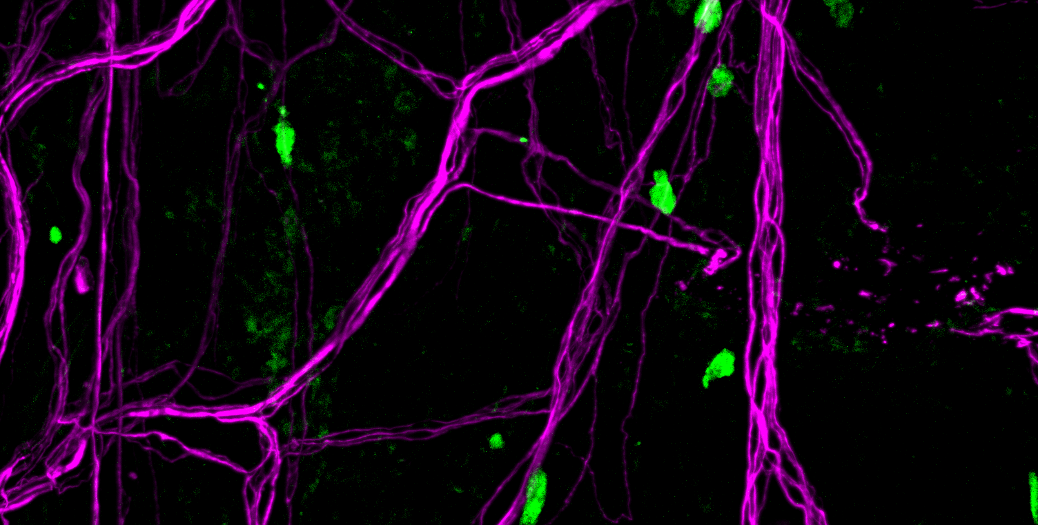 Regulatory T cell and nerves interacting in the meninges surrounding the mouse brain.