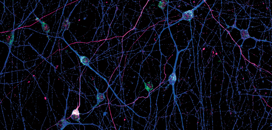 This confocal image shows stem-cell-derived ineurons labeled for phosphorylated α-synuclein, a protein linked to Parkinson’s disease.