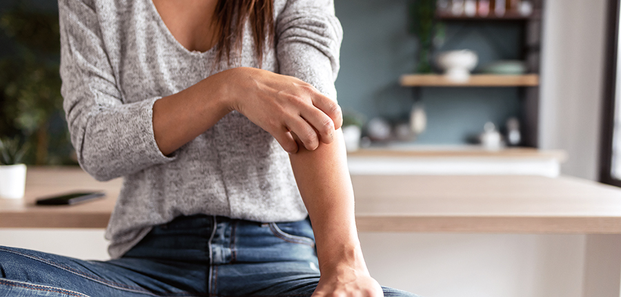 Photo of woman itching arm