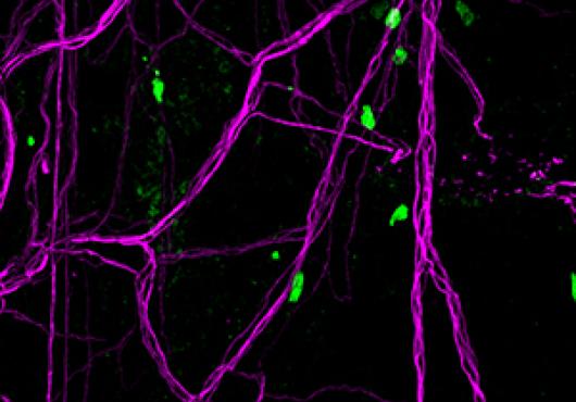 Regulatory T cells (green) and nerves (magenta) interacting in the meninges surrounding the mouse brain. Photo from Dr. Mathis' Lab.