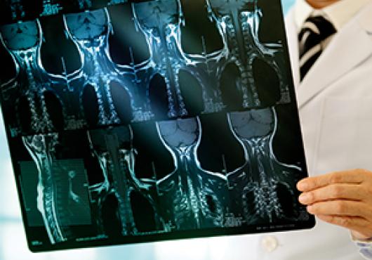 Image of doctor holding x-ray scan