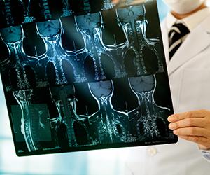 Image of doctor holding x-ray scan